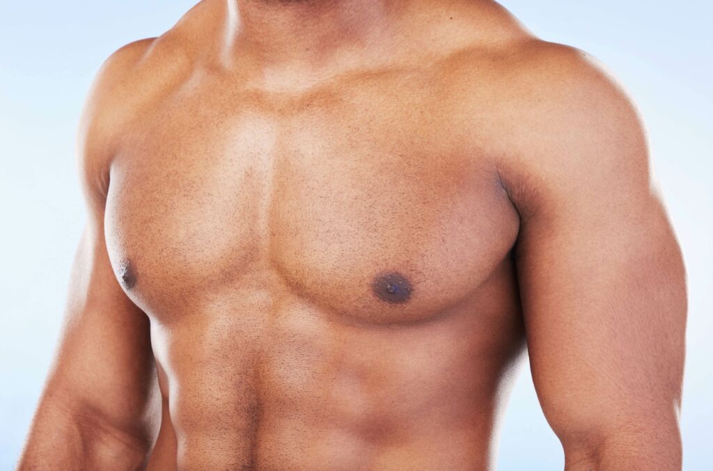 Gynecomastia NYC